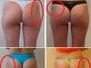 Effective exercises for lifting the buttocks